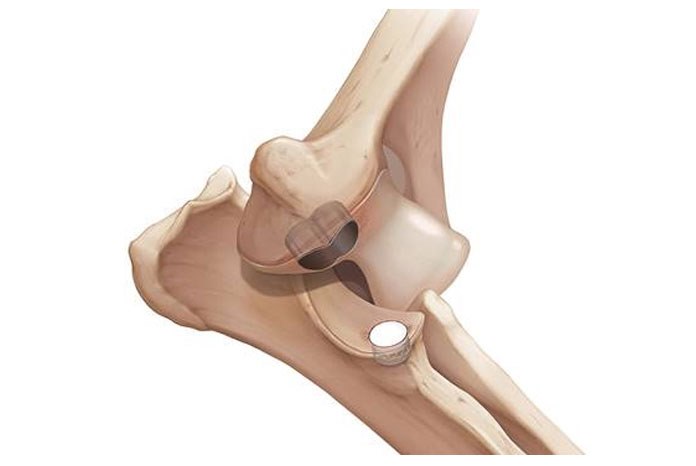 Davies Veterinary Specialists has announced that it is now offering Canine Unicompartmental Elbow replacement (CUE), a new surgical procedure for dogs with canine elbow dysplasia.