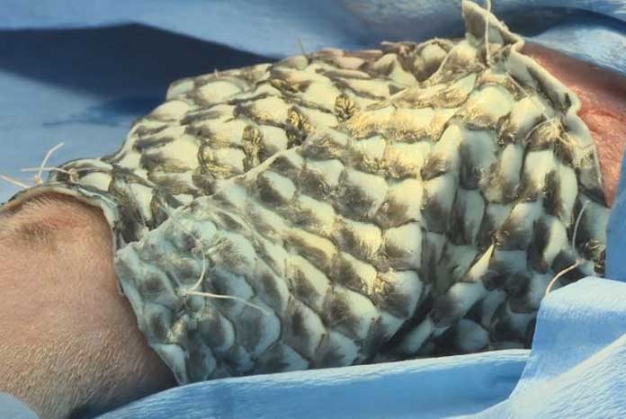 Skeldale Veterinary Centre reports that it has performed the world's first fish skin graft on a dog that was 'days from death' from a seriously infected wound.