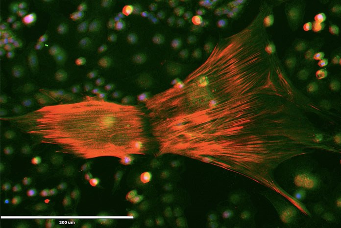 generate pluripotent stem cells