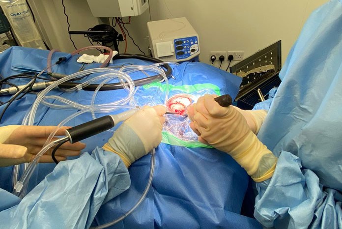 Surrey-based North Downs Specialist Referrals (NDSR) has installed a £55,000 SonoCure ultrasonic surgical aspirator which it says will allow it to take tumour treatment to another level. 